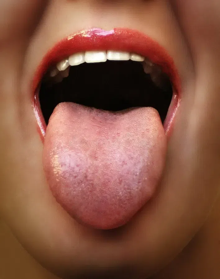 What your tongue says about your health: 7 signs you shouldn't ignore
