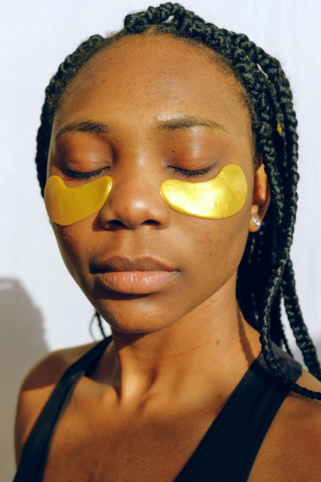 Seek professional treatment for dark eye circles
