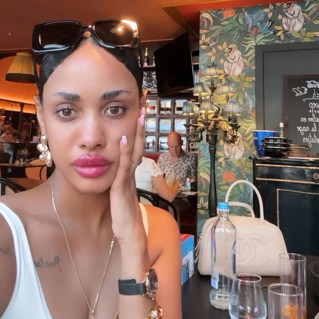 11 cosmetic surgeries common among Kenyan celebrities