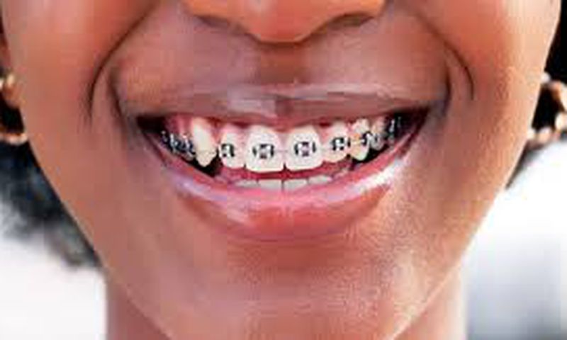A person with braces