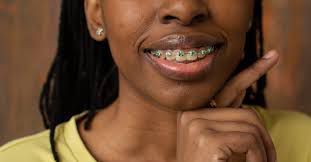 Teeth braces side effects: What you should know before getting them