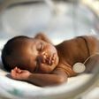 Is premature birth common for twin babies?