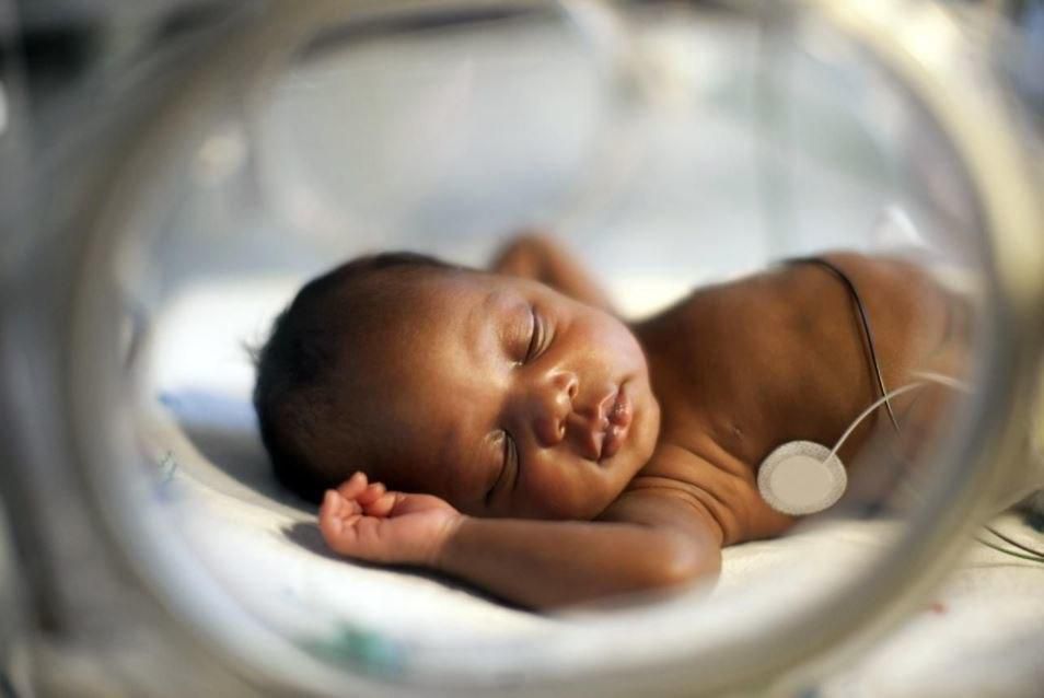 Baby in incubator(courtesy)