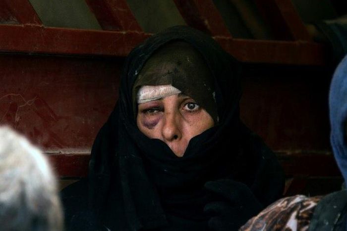 An Iraqi woman, who has fled fighting between government forces and the last jihadists in Mosul's Old City, awaits to be relocated on July 8, 2017