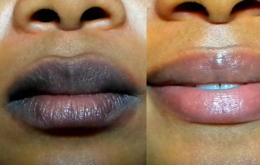 ___9196020___2018___12___13___13___lip