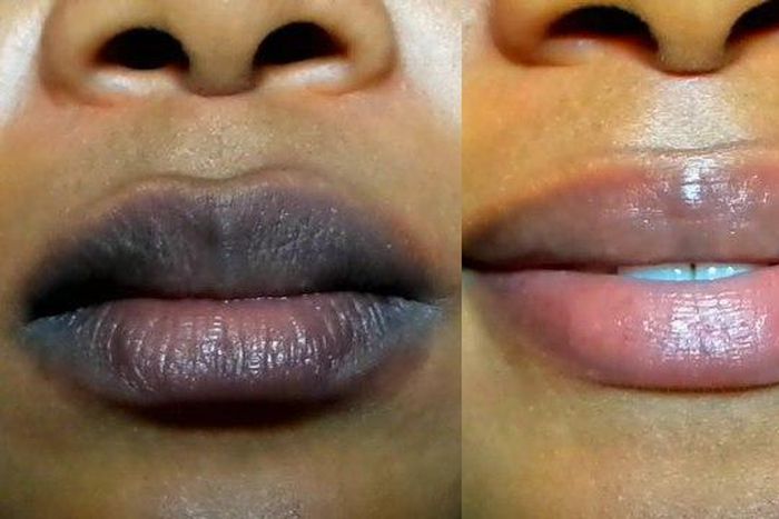 ___9196020___2018___12___13___13___lip