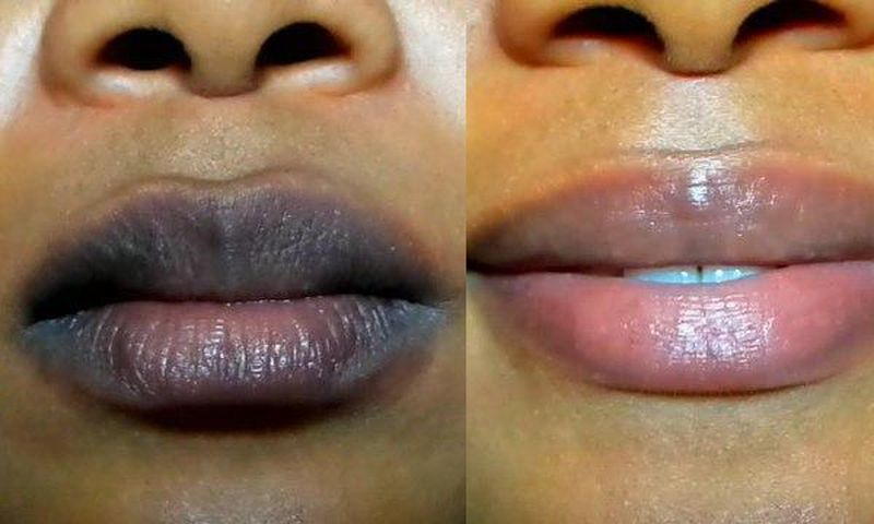 ___9196020___2018___12___13___13___lip