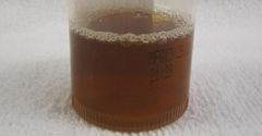 dark urine (Health Library)