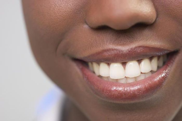 5 natural ways to make your teeth white and shiny