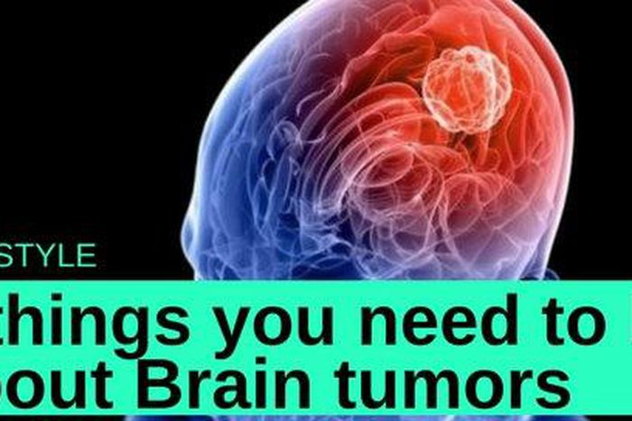 ___7070173___https:______static.pulse.com.gh___webservice___escenic___binary___7070173___2017___7___30___12___brain