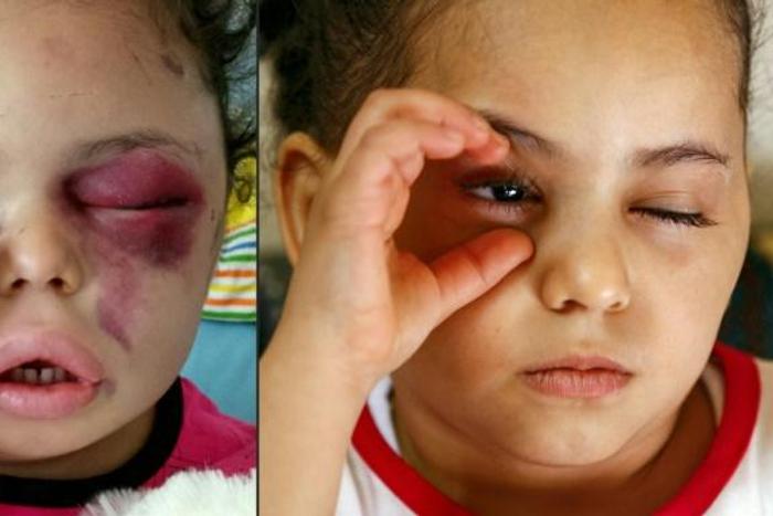 Buthaina Mansur al-Rimi in a photo beamed worldwide after the 2017 air strike that wiped out her immediate family, and today