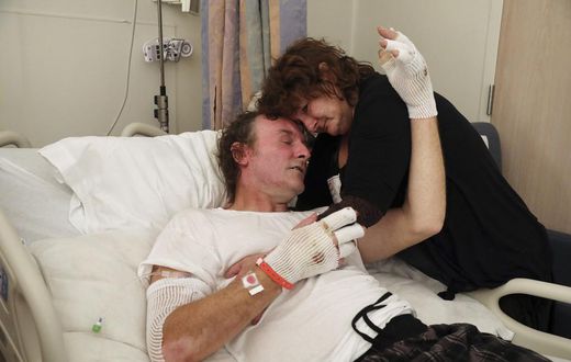 Wildfire Burn Victims 'Live That Nightmare Every Day'