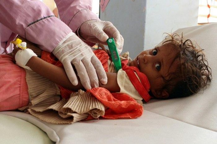 The collapse of Yemen's infrastructure after more than two years of war has made the country's cholera epidemic the worst in the world