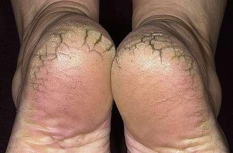 ___8875293___2018___9___19___15___feet