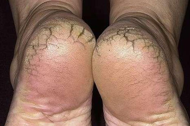 ___8875293___2018___9___19___15___feet