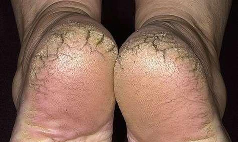 ___8875293___2018___9___19___15___feet