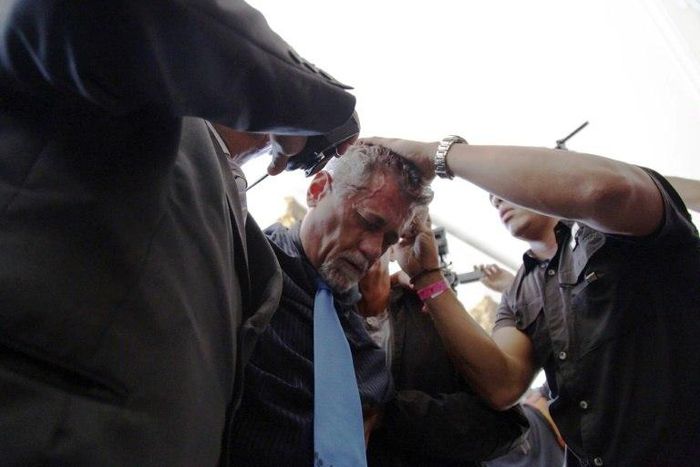 Opposition deputy Americo De Grazia was among at least five lawmakers injured when supporters of Venezuelan President Nicolas Maduro stormed into the National Assembly building