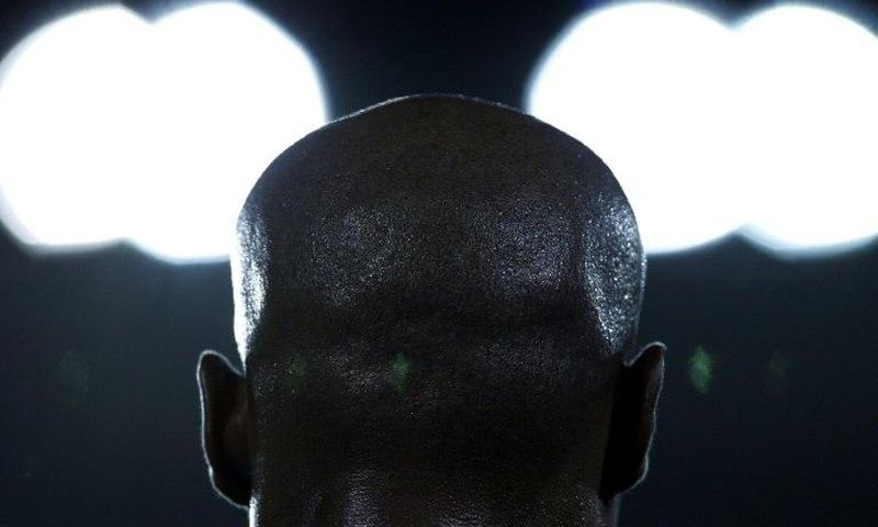 Bald individuals are rich, according to Mozambique superstition and culture