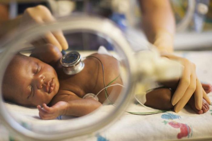 A premature delivery occurs when the baby is born before the 37th gestation week.