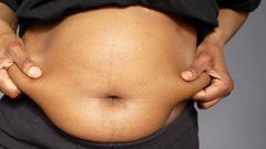 ___9172832___2018___12___6___10___belly+fat