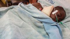 A child is treated in hospital after being injured during a stampede in Malawi's capital Lilongwe on July 6, 2017