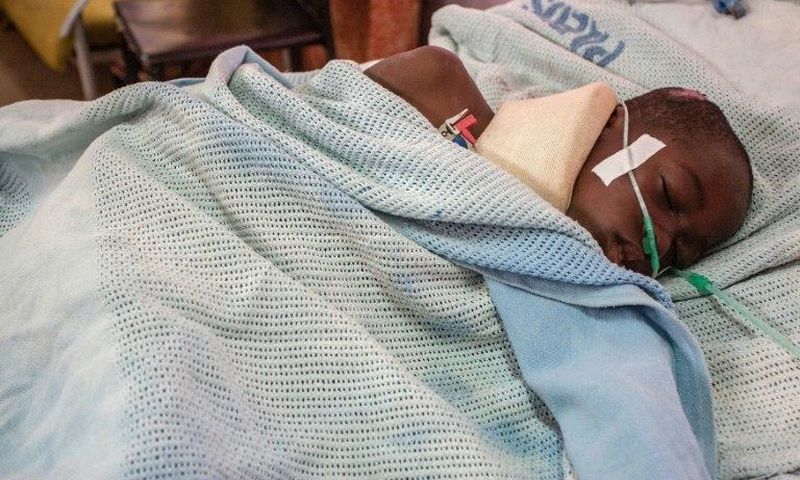 A child is treated in hospital after being injured during a stampede in Malawi's capital Lilongwe on July 6, 2017