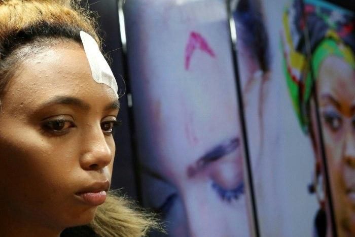 South African model Gabriella Engels has accused Zimbabwe's First Lady Grace Mugabe of beating her with an electrical extension cable at a Johannesburg hotel
