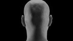 Bald man