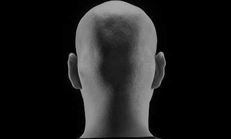 Bald man