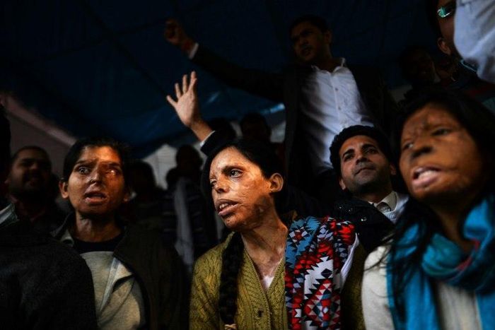 India brought in stringent laws to deal with acid attacks in 2013 following public outcry over the plight of hundreds of survivors who battle lifelong scars and social stigma