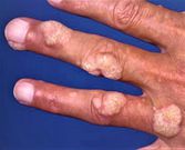 6 diseases you are likely to pick from the salon