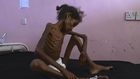 This Is What Our Yemen Policy Looks Like