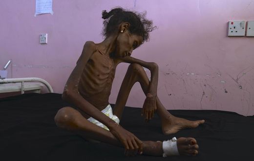 This Is What Our Yemen Policy Looks Like