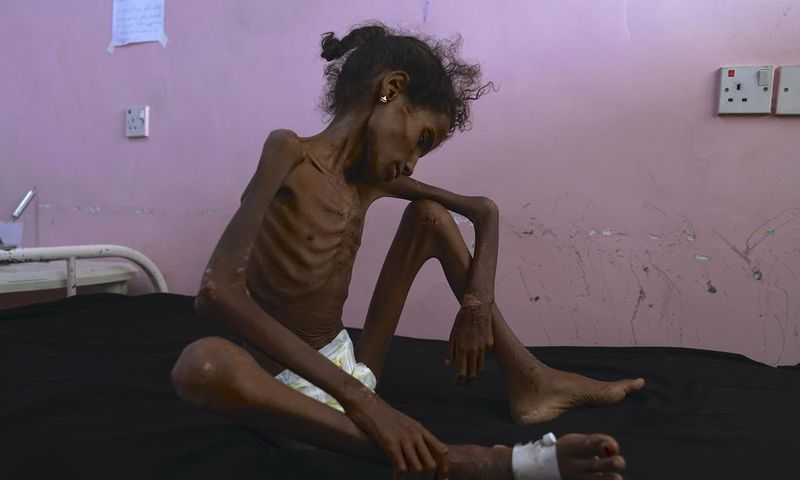 This Is What Our Yemen Policy Looks Like