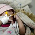 Coping with Yemen's cholera outbreak is all the more difficult because the conflict has devastated the country's health system, says WHO