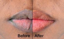 Here's a simple method to lighten dark lips naturally