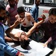 Kashmiri villagers bring a resident injured by Indian security personnel to the main hospital in Srinagar on July 3, 2017