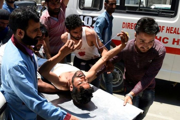Kashmiri villagers bring a resident injured by Indian security personnel to the main hospital in Srinagar on July 3, 2017