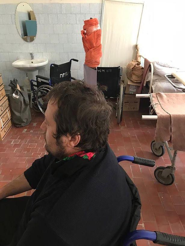 Man plunges knife into his own skull so he can 'breathe better' (Photos)