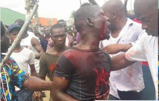 A member of the Badoo gang in a blood-stained shirt.