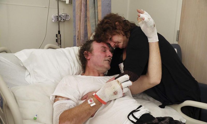 Wildfire Burn Victims 'Live That Nightmare Every Day'