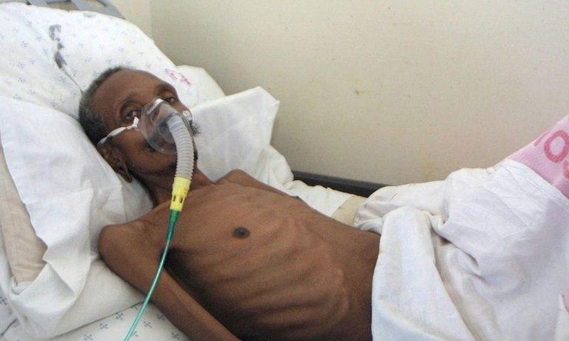 About one in five TB cases are resistant to at least one antibiotic, and about five percent are so-called multidrug resistant (MDR-TB) strains