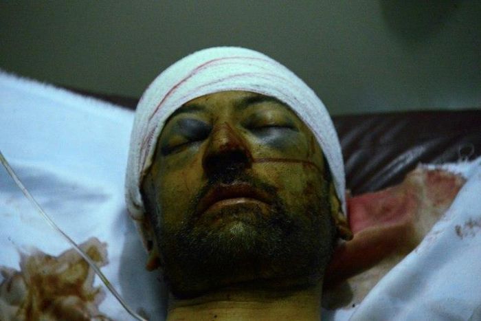 A survivor of the mosque attack receives treatment in hospital