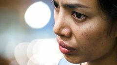 Natural remedies to remove dark spots on your face  [homeremedyhacks]