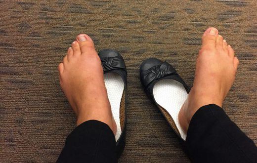 ___9057283___2018___11___1___15___smelly+feet