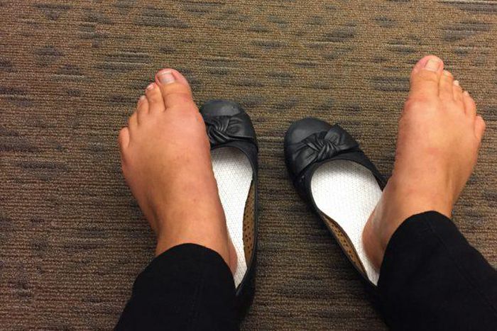 ___9057283___2018___11___1___15___smelly+feet