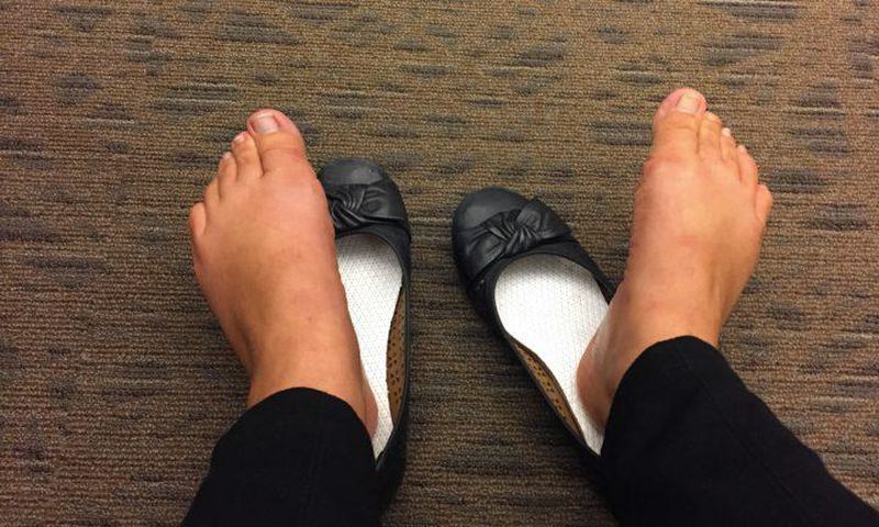 ___9057283___2018___11___1___15___smelly+feet