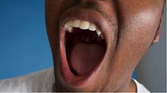 Bad breath (Leapfame)