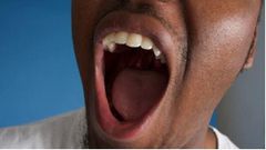 Bad breath (Leapfame)