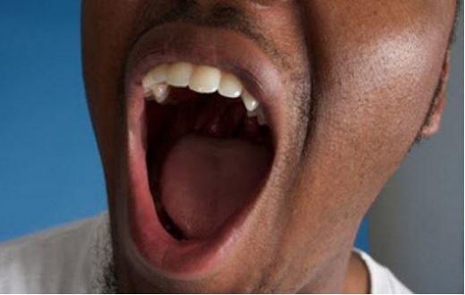 Bad breath (Leapfame)